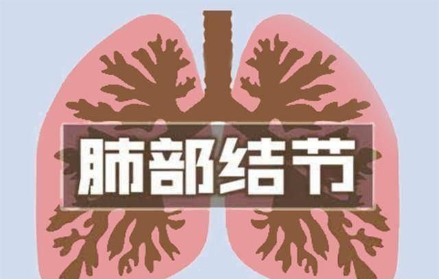 肺上有结节是怎么回事，肺结节是怎么回事图7