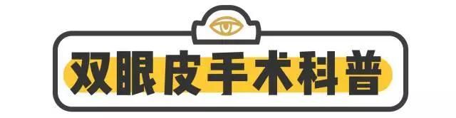 做开眼角哪好:割了双眼皮和开眼角要多久恢复好图1