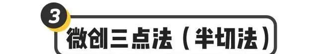 做开眼角哪好:割了双眼皮和开眼角要多久恢复好图8