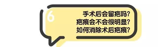 做开眼角哪好:割了双眼皮和开眼角要多久恢复好图29