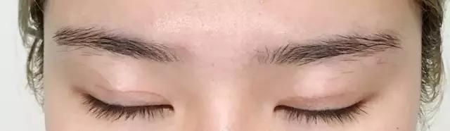 做开眼角哪好:割了双眼皮和开眼角要多久恢复好图30