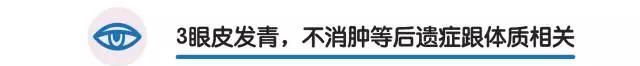 做开眼角哪好:割了双眼皮和开眼角要多久恢复好图35