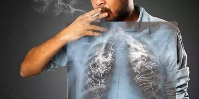 肺癌第一大国:肺癌和抽烟真有关系图8