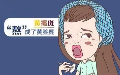 彩光治疗黄褐斑：黄褐斑如何祛除