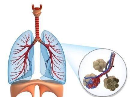 肺炎有多少种:肺炎的症状有哪些图2