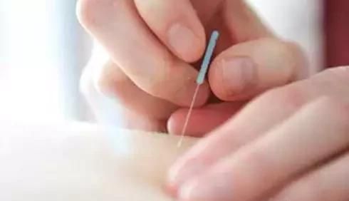 学习艾灸：学习扎针拔罐刮痧艾灸，应该怎么入手图3