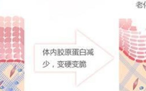 微整形面部提升：如何进行面部提升
