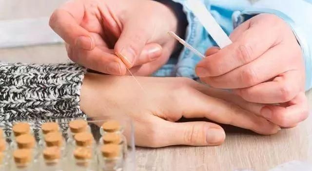日常急救小常识：中医救目前应如何发展有哪些简便易行的中医救小常识呢图1