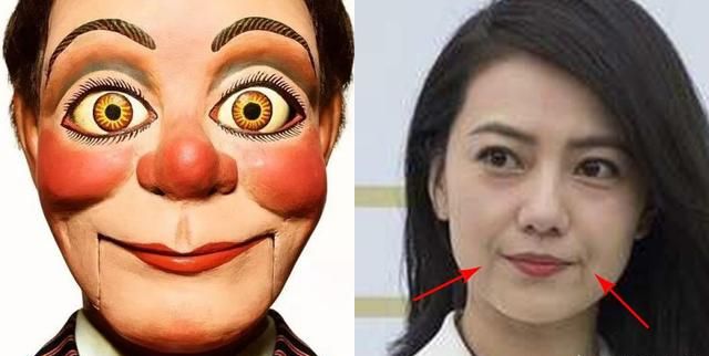 消除法令纹最好的方法，要怎么样才能去除法令纹和木偶纹呢，有没有什么好方法图2
