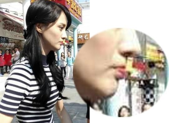 消除法令纹最好的方法，要怎么样才能去除法令纹和木偶纹呢，有没有什么好方法图4
