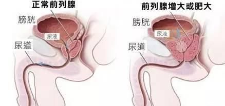 生殖健康知识，中年男人该如何保护生殖健康图2