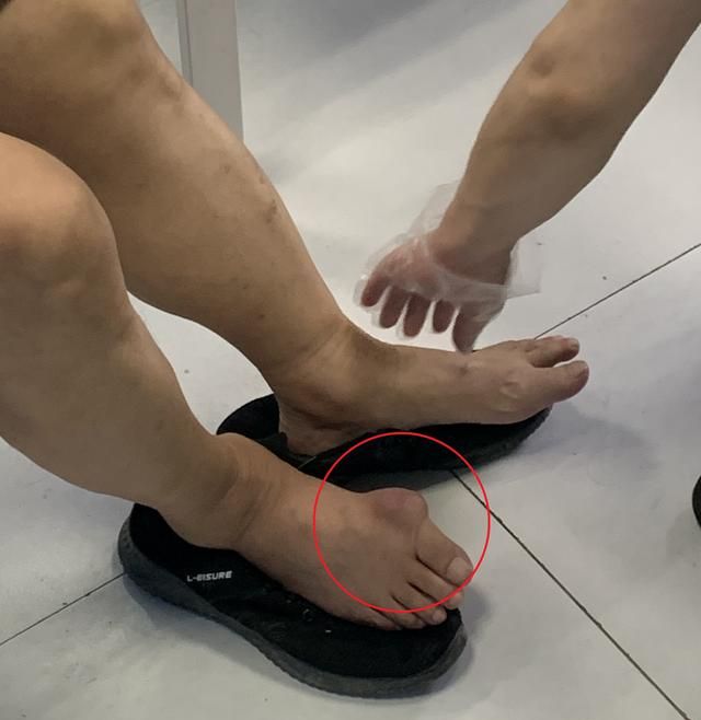 非布司他片作用与功效副作用，痛风吃了非布司他片后，身体到处痛是什么原因呢图3