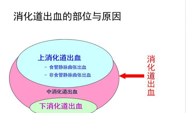 怎么区分痔疮出血和肠道出血：胃出血还是肠出血该如何判定图7