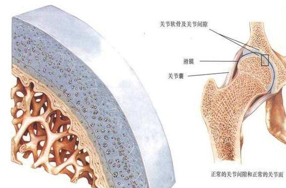 关节炎病因：骨关节炎的常见病因有哪些图8