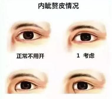 开眼角有危险么,开眼角危险吗需要注意哪些事项图2