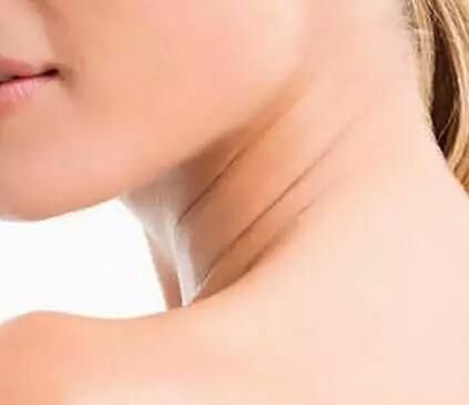 如何保养颈部：夏季女性要如何保养颈部图9