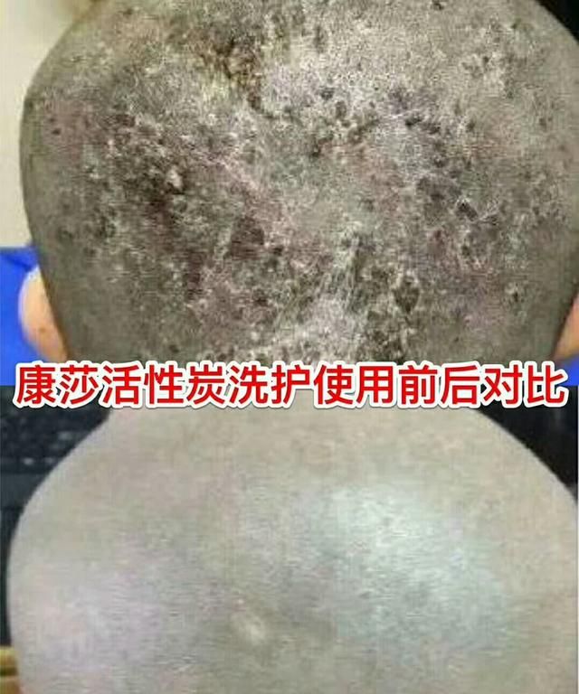 头发爱出油用什么洗发水比较好呢图8