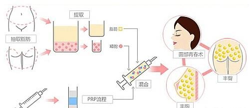 额头抬头纹，额头有抬头纹好吗图4