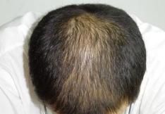 生姜水洗头，可以长期用生姜水洗头吗图3
