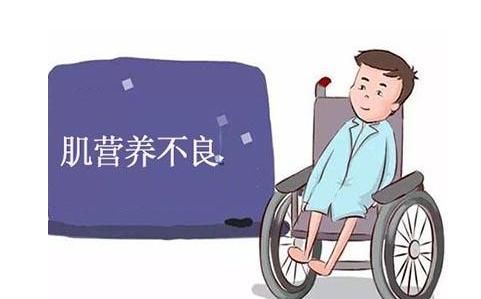 营养不良的表现，肌营养不良的症状有哪些图1