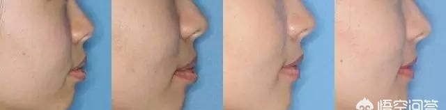 没有下巴或者下巴短小的女人该怎么办不整容的情况下如何改善脸型图3
