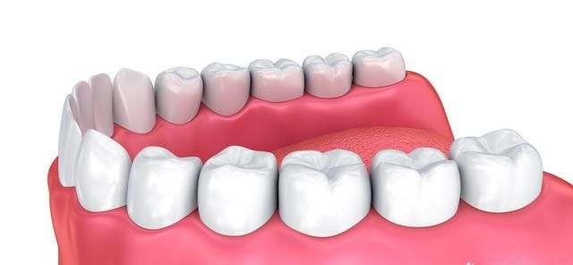 种牙有哪些危害，做种植牙对身体有哪些要求图1