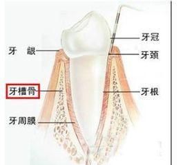 种牙有哪些危害，做种植牙对身体有哪些要求图5