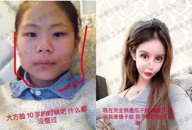 为何当下很多年轻的女性选择做整形美容手术您对美容整形怎么看图5