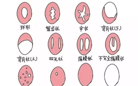 杭州90后年轻妈妈怀上二胎，处女膜竟完好无损，你怎么看