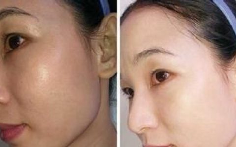 肤色不均怎么办,脸上有色斑肤色不均怎么办