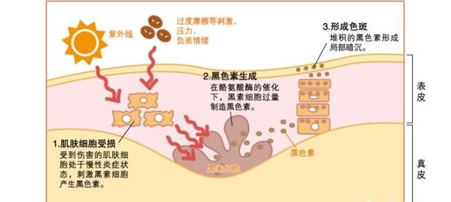 肤色不均怎么办，脸上有色斑肤色不均怎么办图8