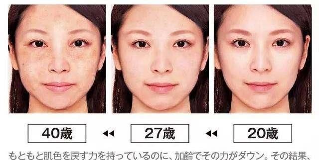 肤色不均怎么办，脸上有色斑肤色不均怎么办图9