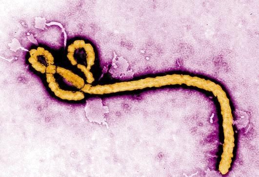 埃博拉病毒为什么会消失，埃博拉病毒为什么会突然消失图1