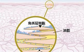 预防白发，如何预防脱发和白发?你要学会这5个妙招图9