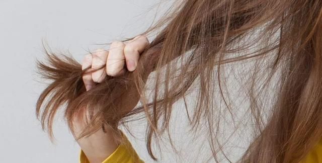 预防白发，如何预防脱发和白发?你要学会这5个妙招图14