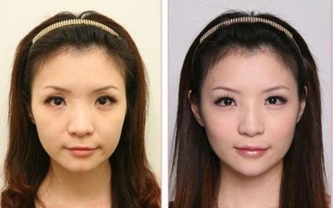 玻尿酸润滑剂对人体有害吗