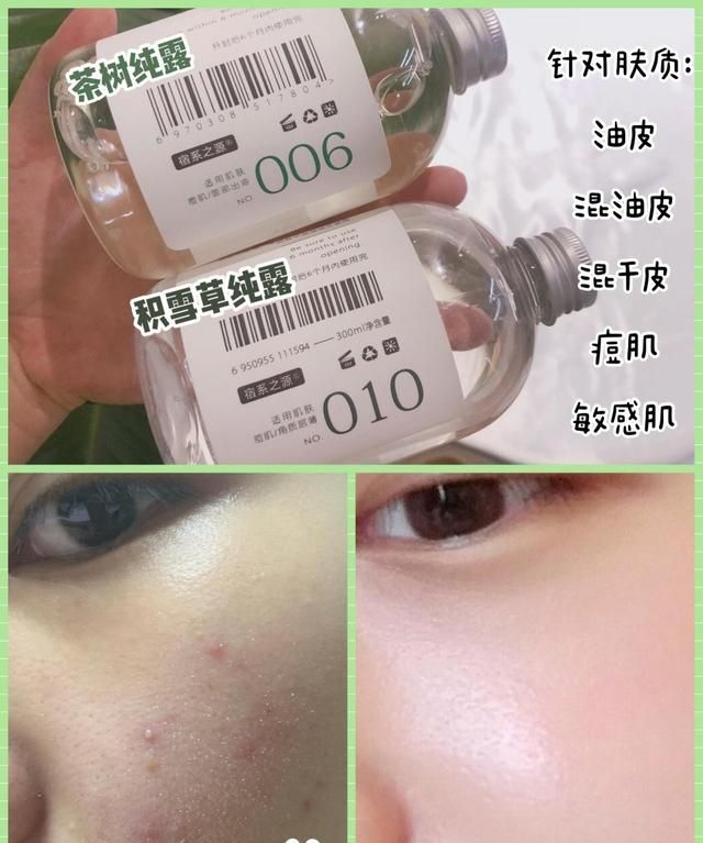 什么纯露祛痘印效果好图5