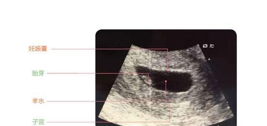 月经周期怎么算，月经周期长怎么算孕周会延长吗图3
