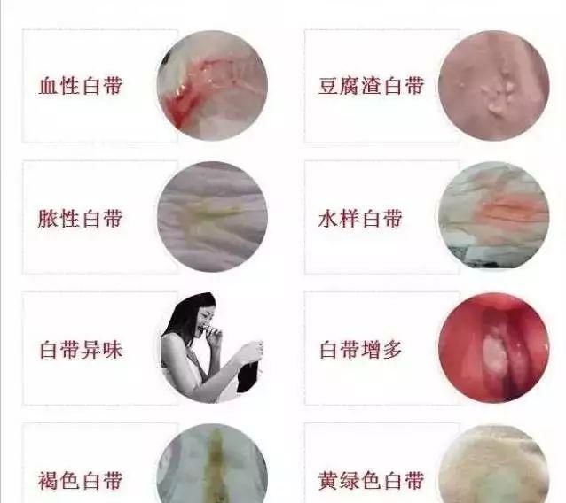 妇科炎症都有啥症状图7