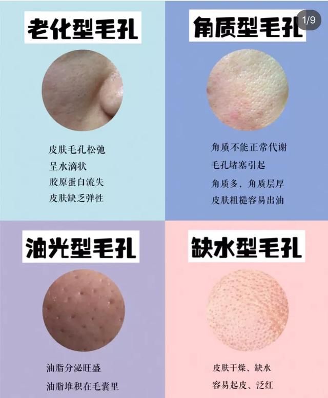怎样缩小脸上的毛孔粗大图1