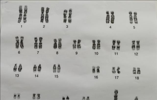 染色体变异图1