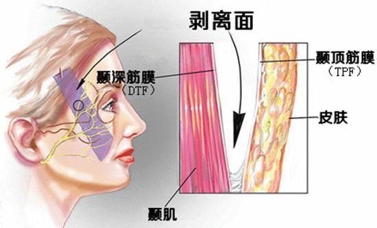 脸上的皮肤松弛怎么办，脸上皮肤松弛怎么办怎么改善呢图4