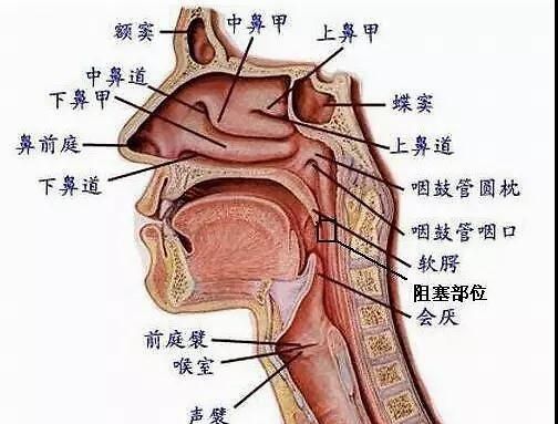 过敏性鼻炎结膜炎，过敏性鼻炎引起过敏性结膜炎怎么办图2