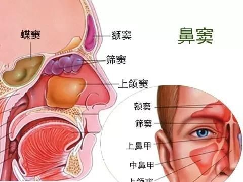 过敏性鼻炎结膜炎，过敏性鼻炎引起过敏性结膜炎怎么办图3