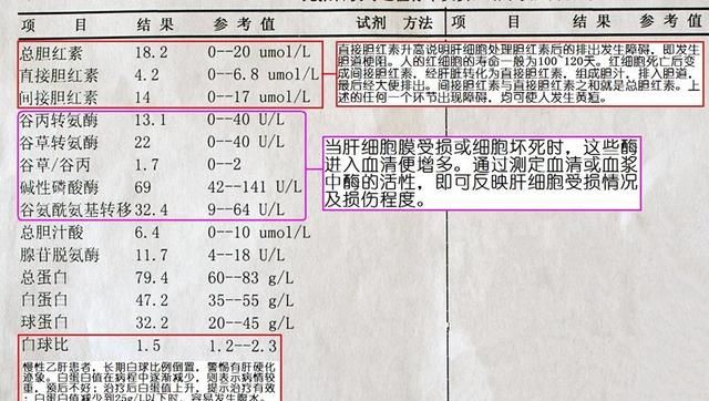 化验单上哪些内容反映肝功能是否正常?图2