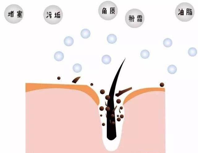 痘坑最有效的方法图10