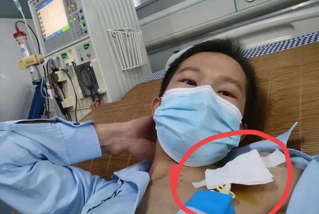 透析是什么，做透析是什么感觉图2