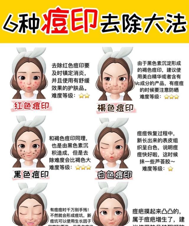 痤疮痘印，怎么才能去掉脸上的痘痘和痘印图2