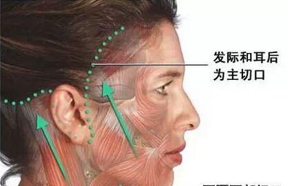 60岁能做拉皮手术吗图6