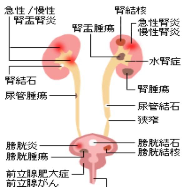 尿出来都是血，小便出血可能是什么原因图4